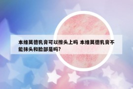 本维莫德乳膏可以擦头上吗 本维莫德乳膏不能抹头和脸部是吗?