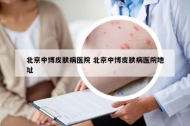 北京中博皮肤病医院 北京中博皮肤病医院地址
