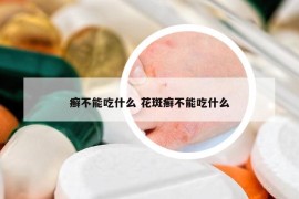 癣不能吃什么 花斑癣不能吃什么