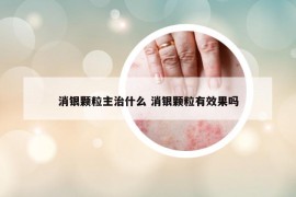 消银颗粒主治什么 消银颗粒有效果吗