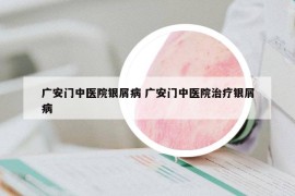 广安门中医院银屑病 广安门中医院治疗银屑病