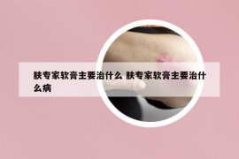 肤专家软膏主要治什么 肤专家软膏主要治什么病