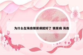 为什么在海南银屑病就好了 银屑病 海南