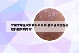 甘肃省中医院皮肤科银屑病 甘肃省中医院皮肤科银屑病专家