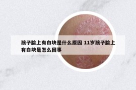 孩子脸上有白块是什么原因 11岁孩子脸上有白块是怎么回事