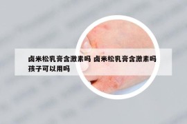 卤米松乳膏含激素吗 卤米松乳膏含激素吗 孩子可以用吗