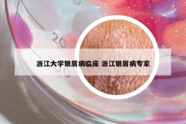 浙江大学银屑病临床 浙江银屑病专家
