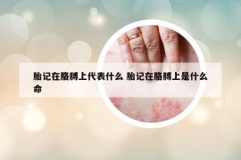 胎记在胳膊上代表什么 胎记在胳膊上是什么命