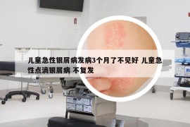 儿童急性银屑病发病3个月了不见好 儿童急性点滴银屑病 不复发