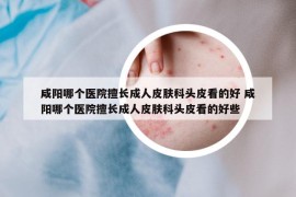 咸阳哪个医院擅长成人皮肤科头皮看的好 咸阳哪个医院擅长成人皮肤科头皮看的好些