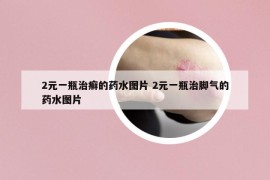 2元一瓶治癣的药水图片 2元一瓶治脚气的药水图片