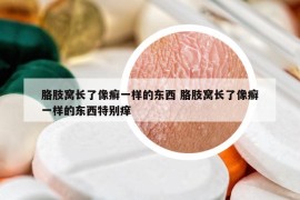 胳肢窝长了像癣一样的东西 胳肢窝长了像癣一样的东西特别痒