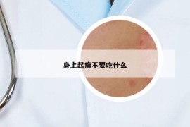 身上起癣不要吃什么