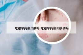 吃避孕药会长癣吗 吃避孕药会长疹子吗