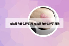 皮肤藓有什么好的药 皮肤藓有什么好的药物