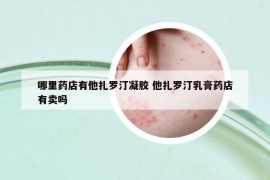 哪里药店有他扎罗汀凝胶 他扎罗汀乳膏药店有卖吗