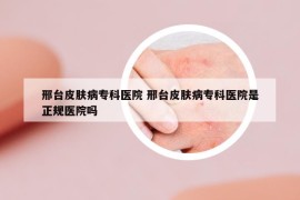 邢台皮肤病专科医院 邢台皮肤病专科医院是正规医院吗