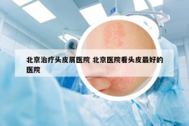 北京治疗头皮屑医院 北京医院看头皮最好的医院