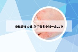 华佗膏多少钱 华佗膏多少钱一盒20克