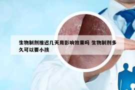 生物制剂推迟几天用影响效果吗 生物制剂多久可以要小孩