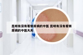昆明有没有看银屑病的中医 昆明有没有看银屑病的中医大夫
