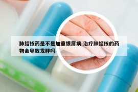 肺结核药是不是加重银屑病 治疗肺结核的药物会导致发胖吗