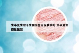 生半夏生附子生胆南星治皮肤病吗 生半夏生南星医案