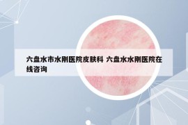 六盘水市水刚医院皮肤科 六盘水水刚医院在线咨询