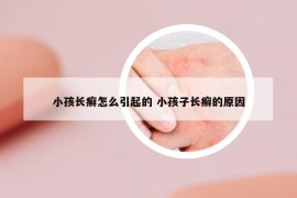 小孩长癣怎么引起的 小孩子长癣的原因