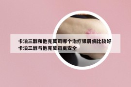 卡泊三醇和他克莫司哪个治疗银屑病比较好 卡泊三醇与他克莫司更安全