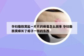 孕妇胳肢窝起一片片的癣是怎么回事 孕妇胳肢窝痒长了痱子一样的东西