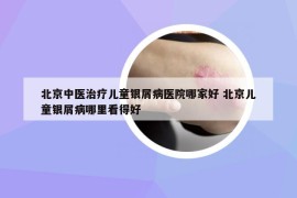 北京中医治疗儿童银屑病医院哪家好 北京儿童银屑病哪里看得好