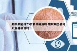 银屑病能打23价肺炎疫苗吗 银屑病患者可以接种疫苗吗