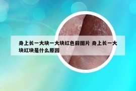 身上长一大块一大块红色藓图片 身上长一大块红块是什么原因