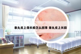 睾丸皮上像长癣怎么回事 睾丸皮上长藓