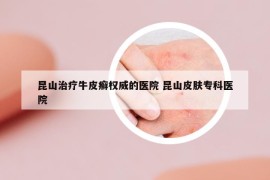 昆山治疗牛皮癣权威的医院 昆山皮肤专科医院