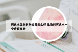 阿达木生物制剂效果怎么样 生物剂阿达木一个疗程几针