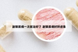 副银屑病一次就治好了 副银屑病好转迹象