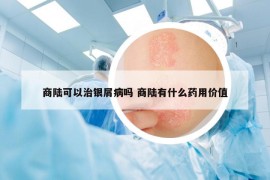 商陆可以治银屑病吗 商陆有什么药用价值