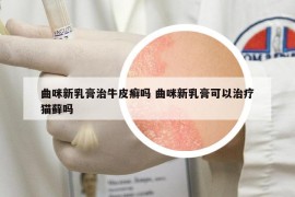 曲咪新乳膏治牛皮癣吗 曲咪新乳膏可以治疗猫藓吗