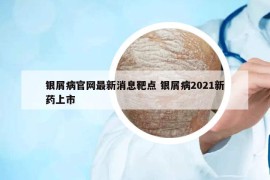 银屑病官网最新消息靶点 银屑病2021新药上市
