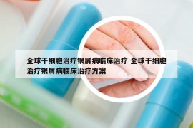 全球干细胞治疗银屑病临床治疗 全球干细胞治疗银屑病临床治疗方案