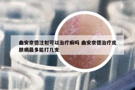 曲安奈德注射可以治疗癣吗 曲安奈德治疗皮肤病最多能打几支