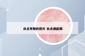 白点早期的照片 白点病前期