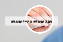 银屑病指南专家共识 银屑病指南 完整版