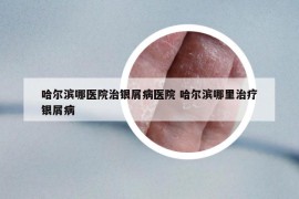哈尔滨哪医院治银屑病医院 哈尔滨哪里治疗银屑病