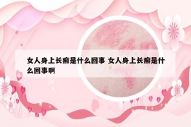 女人身上长癣是什么回事 女人身上长癣是什么回事啊
