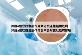 异维a酸软胶囊副作用太可怕还能继续吃吗 异维a酸软胶囊副作用会不会对我以后有影响