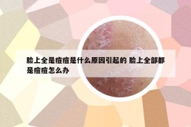 脸上全是痘痘是什么原因引起的 脸上全部都是痘痘怎么办
