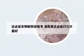 达必妥生物制剂说明书 湿疹用达必妥打几针最好